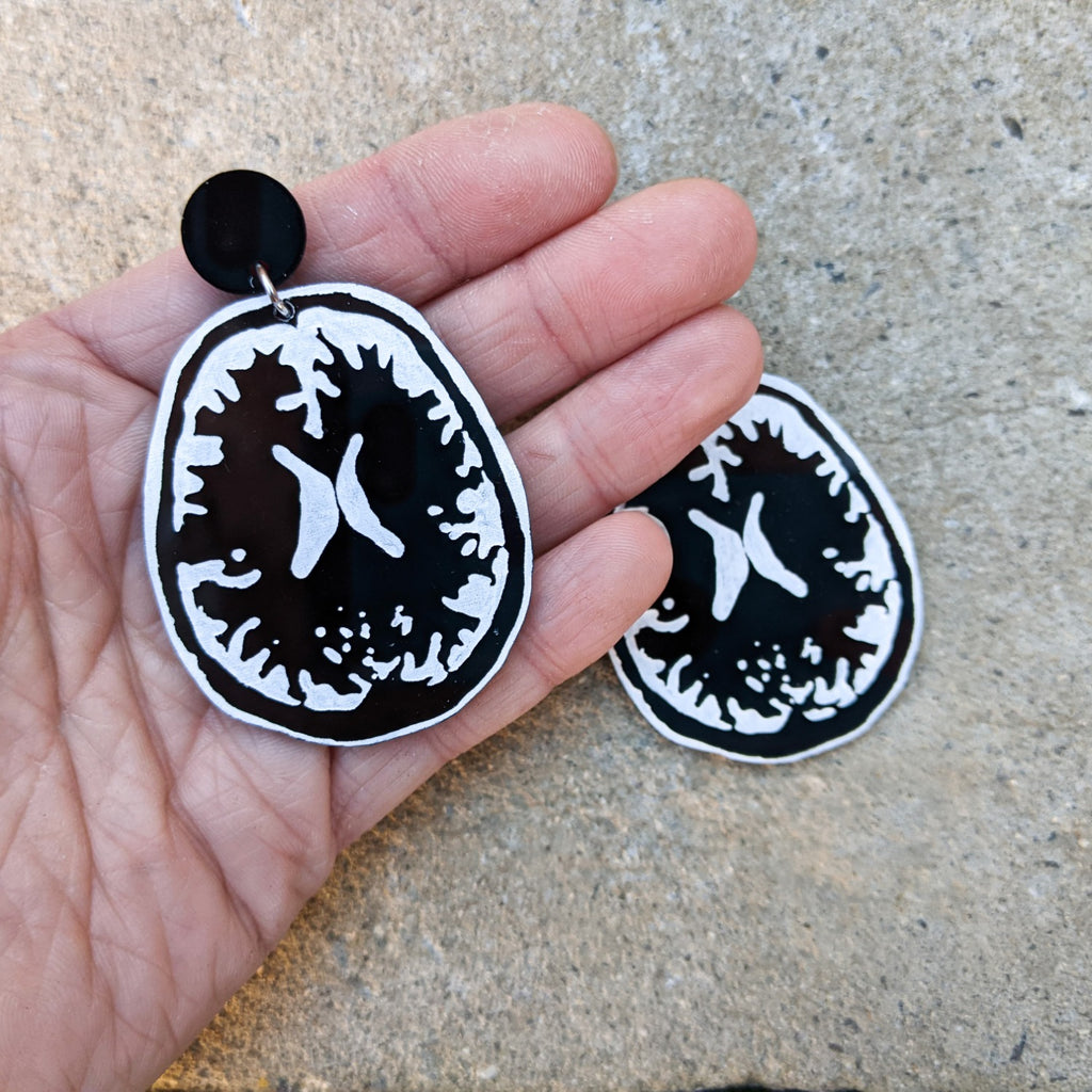 Laser Cut Acrylic Brain MRI Earrings in Black and White. In hand for scale.